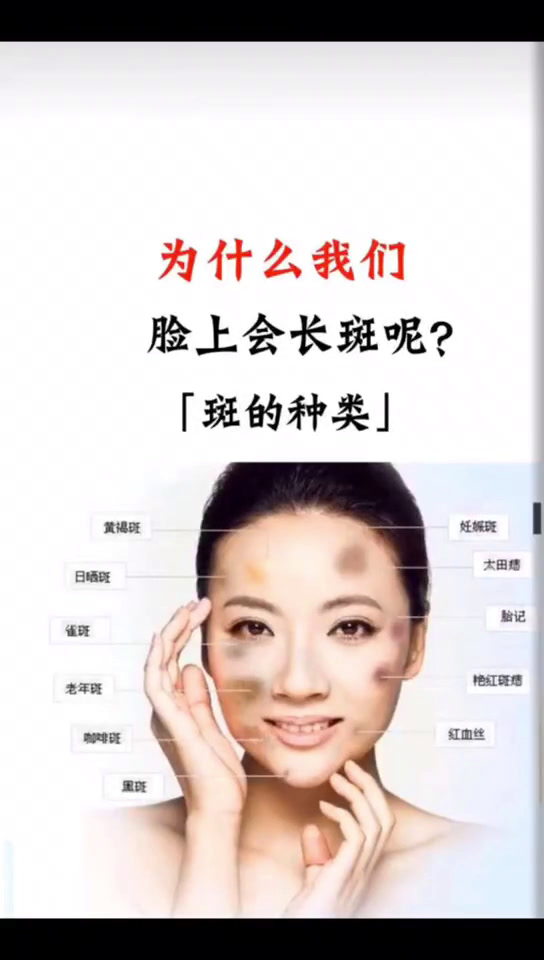 长在脸上的斑都是分哪几种啊?