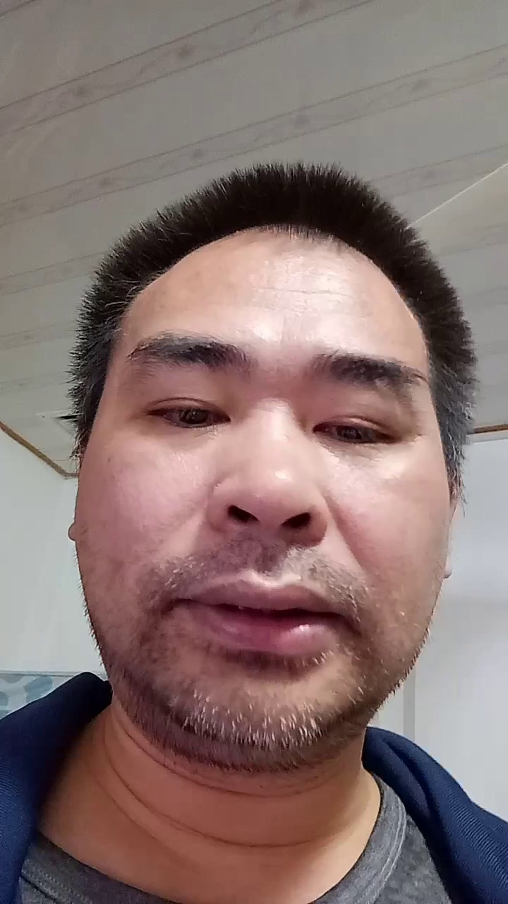 男生刮完胡子,胡子印特别重,特显老,有什么生活小妙招可以淡化胡印