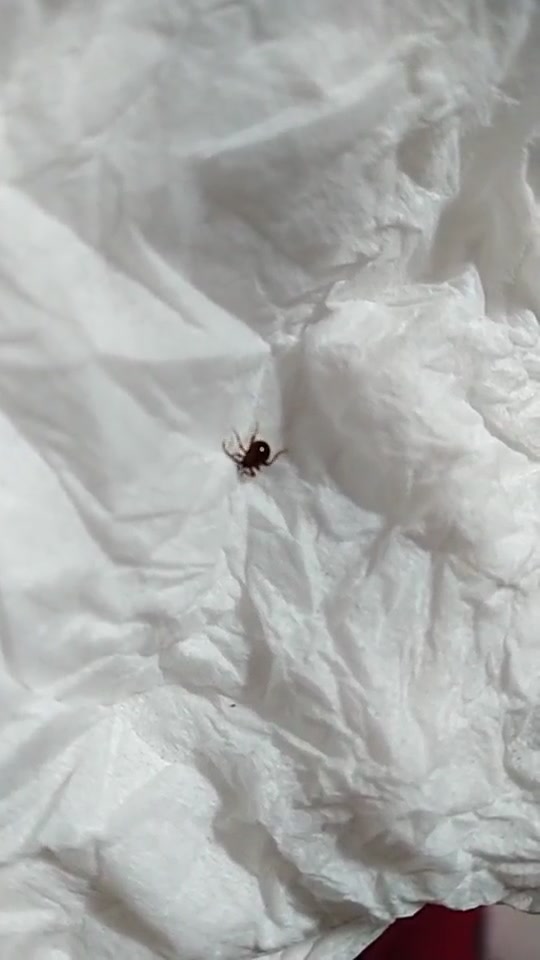 请问这是蜱虫吗?